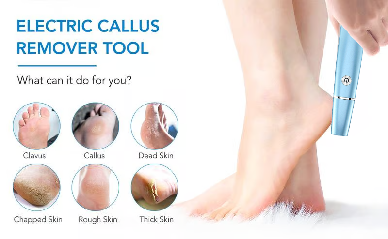 š„Electric Feet Callus Removerā”