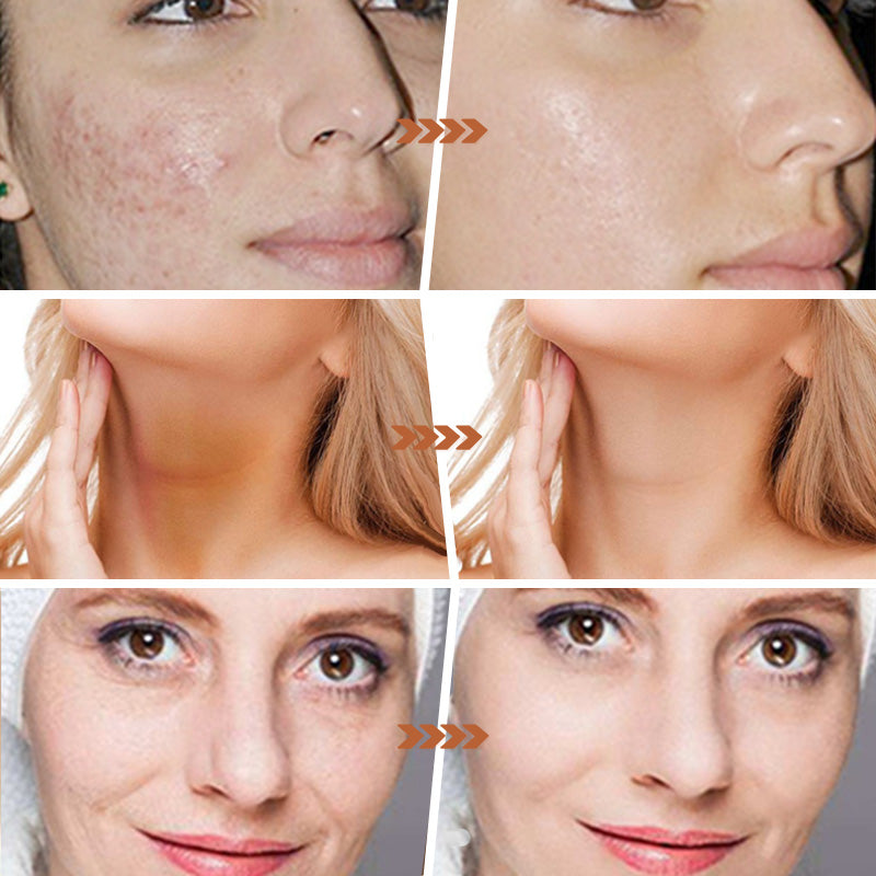 š„Buy 2 Get 1 Freeš§¼Lemon Turmeric & Kojic Acid Soap Bars